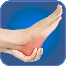 Plantar Fasciitis