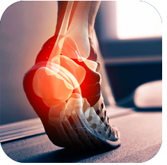 Achilles Tendinitis
