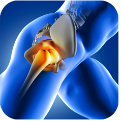 Hip pain