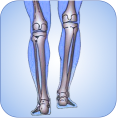 Leg Length Inequality