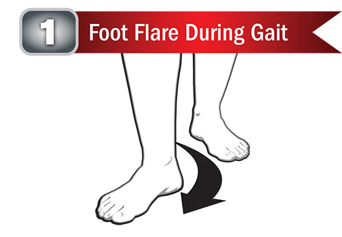 Foot Flare